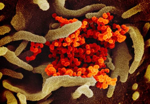 Featured image for post: What the CDC Means By Describing COVID As the ‘Only Cause’ of 6 Percent of Patient Deaths